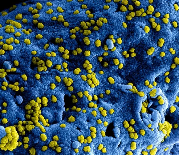 M&aacute;s de la mitad de los nuevos casos confirmados son de personal sanitario