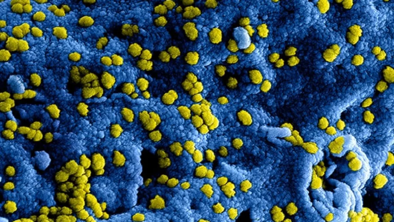 M&aacute;s de la mitad de los nuevos casos confirmados son de personal sanitario